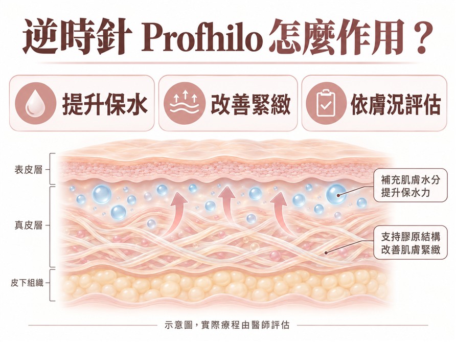 逆時針 Profhilo 作用原理示意，提升保水、改善緊緻並由醫師依膚況評估